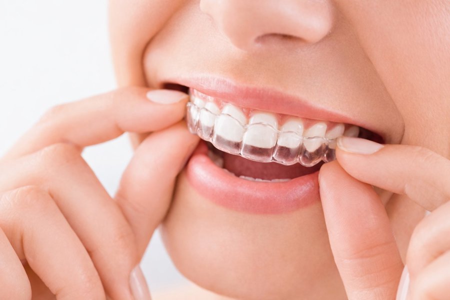 Discreet orthodontic care at our Ashburn, VA dental office